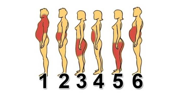 Σε ποια από τις 6 κατηγορίες ανήκετε ανάλογα με τα σημεία του σώματός σας που έχετε περιττό λίπος